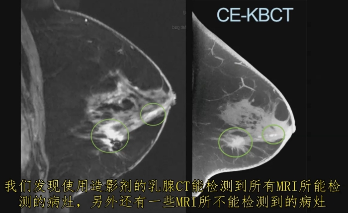KBCT產(chǎn)品優(yōu)勢6